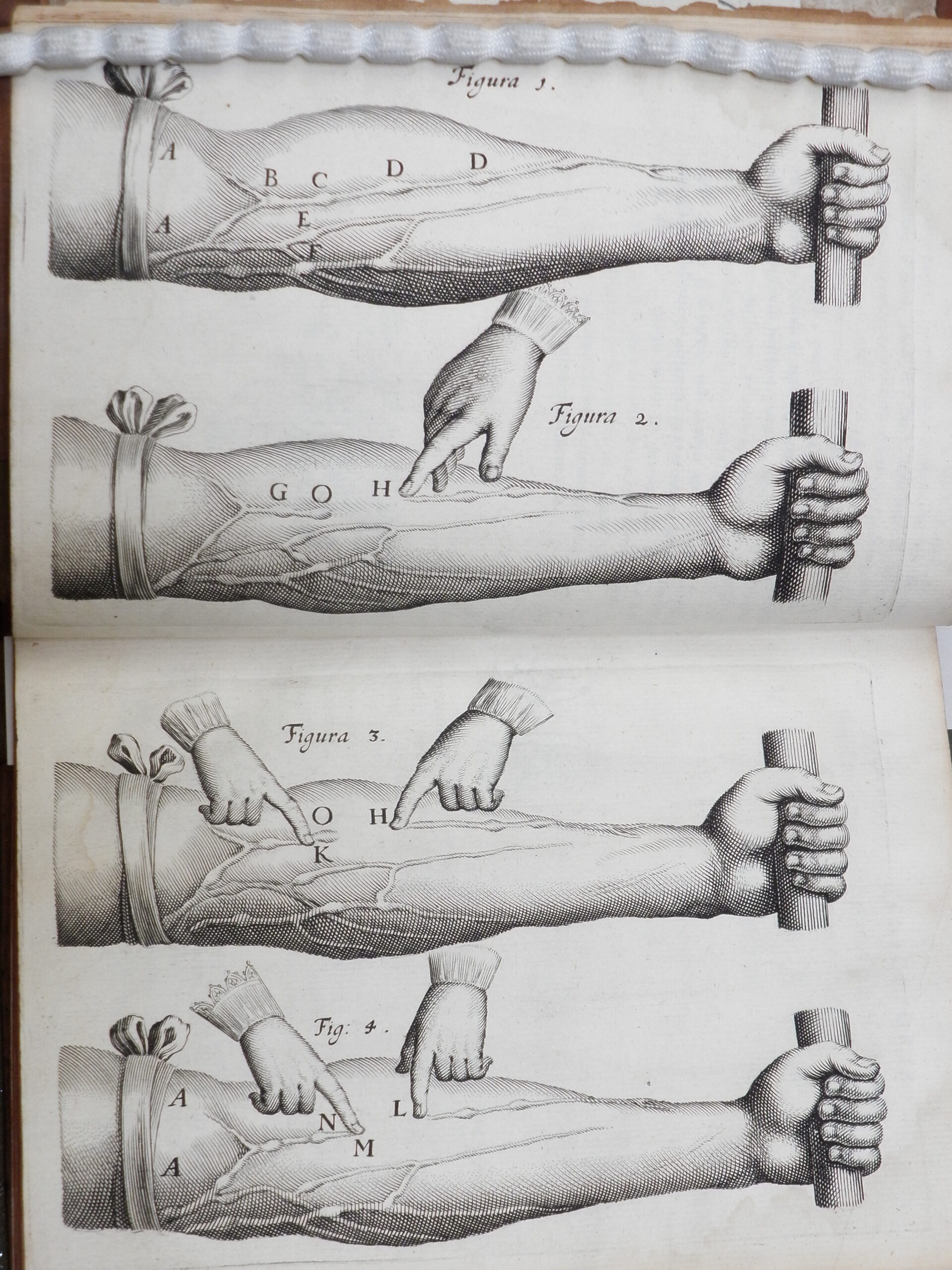Black and white engravings of outstretched forearms with veins labelled.